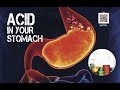 Understanding Stomach Acid and Its Role