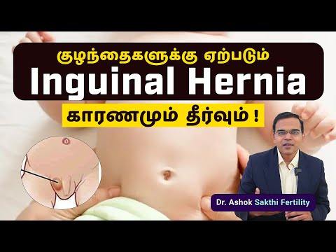 Inguinal Hernia in Babies👉 Causes, Symptoms & Treatment Explained in Tamil  💥 | Must-Know Facts