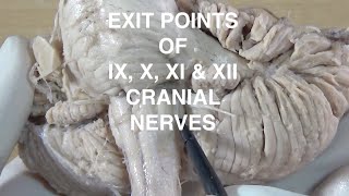 EXIT POINTS OF IX, X, XI & XII CRANIAL NERVES