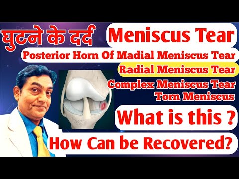 Meniscus tear क्या होता है ?  Meniscus Tear कैसे ठीक करें #meniscustear #meniscusrepair