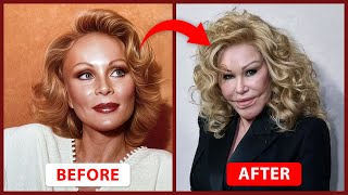 Plastic Surgery Gone Wrong: Celebrities' Shocking Transformations