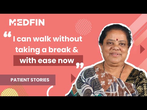 Varicose Vein Surgery with MEDFIN A Patient's Before and After Story