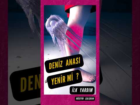 Denizanası yenir mi? Deniz anası sokmaları ısırmaları ilk yardım nasıl yapılır Deniz anası ısırır mı