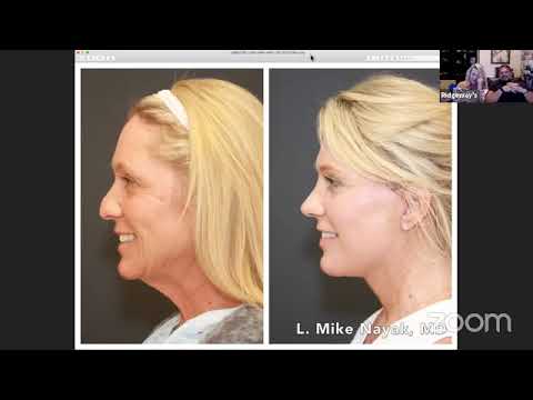 Before and after cosmetic surgery profile comparison.