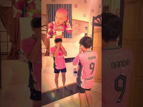 👨🦲🎉Botak Warna 15jt Subscriber Omped Visual✨🥚