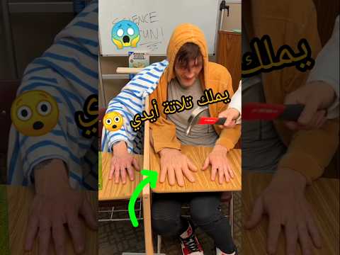 😲😲😲