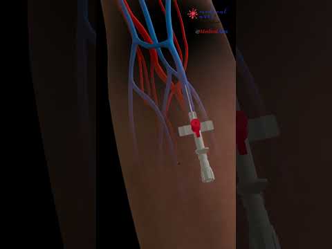 IV Insertion 💉 IntraVenous Catheter ⚕️ 3D Medical Animation Ep.1