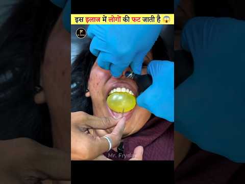 The Most Uncomfortable Treatment 😱