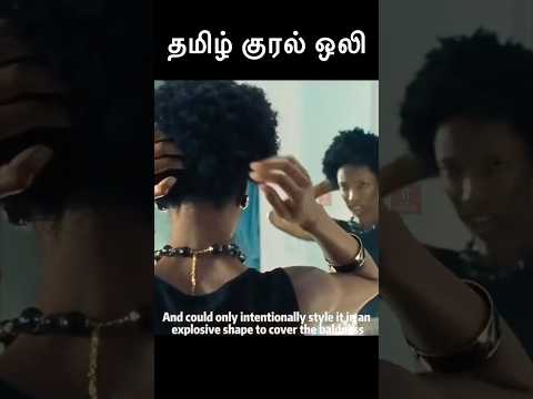 Hair transplant சென்றதால் வந்த கொடூரமான பிரச்சனைகள் || Twist இருக்கு || Let’s Watch ||