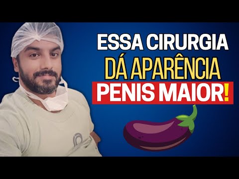 TRÊS CIRURGIAS AUMENTO PENIANO: CIRURGIÃO CONTA TUDO!