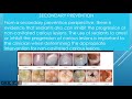 Dental Sealants: Benefits and Misconceptions