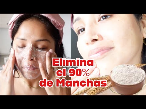 Remueve Las Manchas de Melasma Haciendo esto todos LOS DIAS 🪴