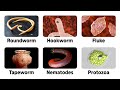 Understanding Parasites and Their Effects