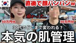 【韓国】いざリベンジ！30代男女の本気の肌管理。30万円でどこまで変われるか？