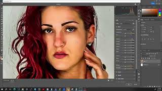 Remove Redness and Adjust Skin Tones - Photoshop