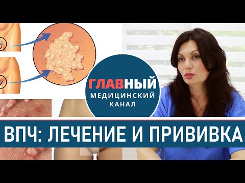 Лечение ВПЧ у женщин и мужчин. Как лечить вирус папилломы человека