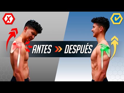 Cómo enderezar los hombros en 10 minutos (¡PARA SIEMPRE!) 💪