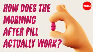 How does the morning-after pill prevent pregnancy? - Alison Edelman