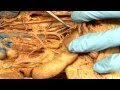 Anatomy of Blood Vessels