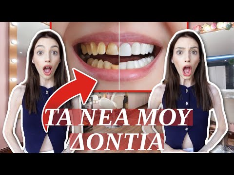 ΤΑ ΝΕΑ ΜΟΥ ΔΟΝΤΙΑ | GLOW UP ΗΜΕΡΟΛΟΓΙΟ ΕΠΕΙΣΟΔΙΟ 7 | Manuella