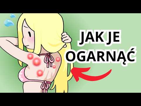 Wstydzisz się przez trądzik na plecach? 😭😭😭
