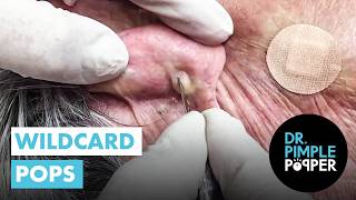 Can you Handle These Wildcard Pops?!
