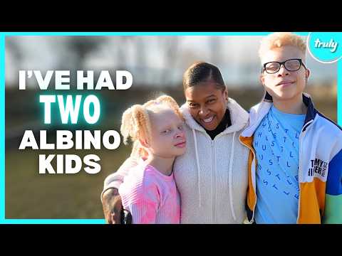 I’m A Mom Of 2 Albino Children | BORN DIFFERENT