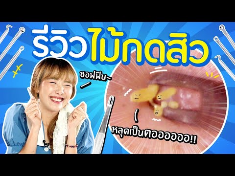 ซอฟรีวิว: ที่กดสิวถนอมผิว ไม่ทิ้งรอยแดง!!【ที่กดสิวหมอมวลชน】