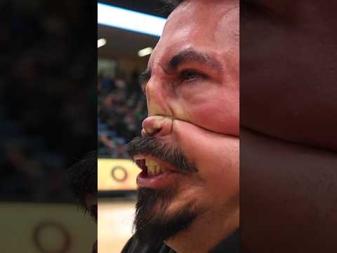 Nose Pulling Game #facts #sports