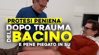 Rinascere dopo un Incidente: La Protesi Peniena e il Ritorno alla Normalità