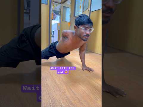 Below Knee Leg Price | Ossur Silicone Liner | Proflex Xc | Artificial Leg Price | #ossur #naklitang