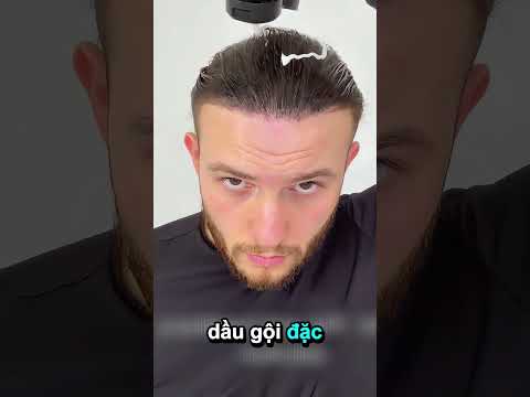 cách anh ấy che đi mái đầu hói!