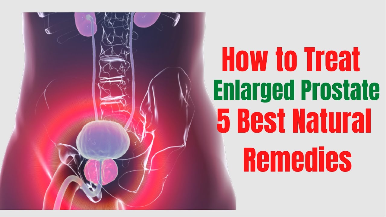 5 Natural Remedies For Enlarged Prostate