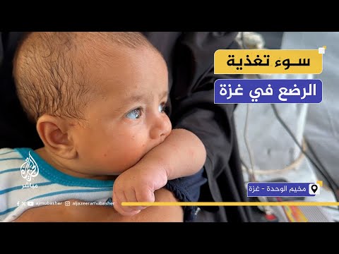 أم فلسطينية: خايفة بنتي تموت من سوء التغذية