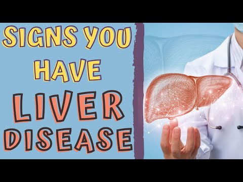 SIGNS THAT YOU HAVE A LIVER DISEASE/ liver disease signs and symptoms
