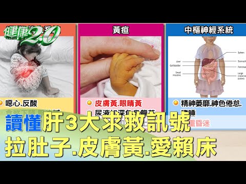 讀懂肝3大求救訊號 孩子拉肚子.皮膚黃.愛賴床 健康2.0