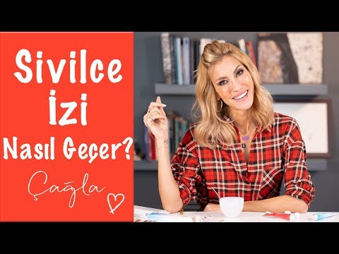 Çağla | Sivilce İzleri Nasıl Geçer? | Güzellik - Bakım