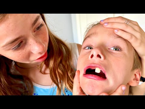 She RIPPED OUT her Brotherโs Tooth!๐ณ