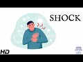 Understanding Shock: Causes and Treatments