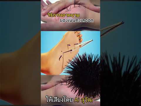 วิธีการเอาหนามของเม่นทะเลออก