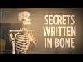 Forensic Analysis of a Skeleton