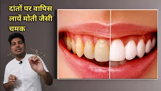 muh ki badboo ka ilaj / teeth whitening / दांतों की सफाई