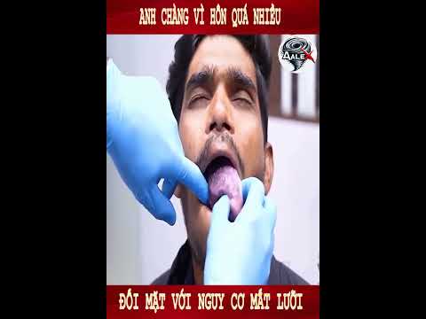 Anh chàng vì hôn quá nhiều đối mặt với nguy cơ mất lưỡi.#shorts #shortvideo #review