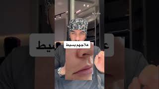 4 حلول فعالة لبشرتك! تصبغات، مسام واسعة، وإكليل الجبل – مع د. طلال المحيسن