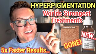 Major Hyperpigmentation Breakthrough - WORLDS STRONGEST DARK SPOT SERUM