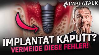 Implantate richtig pflegen – Dein ultimativer Guide