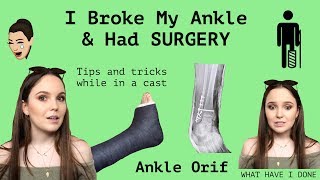 MY STORY | Broken Ankle & Ankle Orif Surgery - Q&A