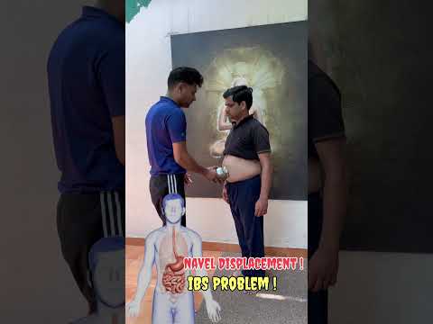 Navel displacement problems! Amazing 🔥🔥Results #yoga #ayurveda #IBS #stomach