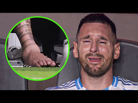DESTROZADO: así le quedó el tobillo a Leo Messi