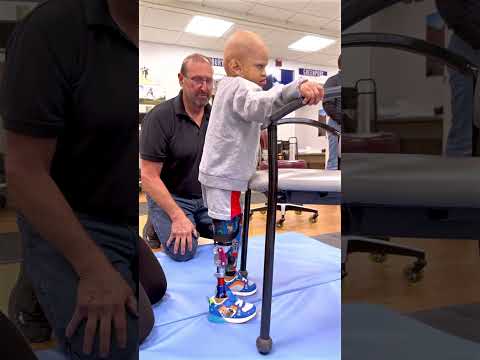 Derek’s Journey with Prosthetic Legs | Bilateral AK/BK Pediatric Amputee